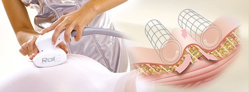 endermologie lipomassage